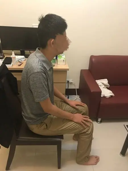 學員第一次評估時的體態：頭部前傾、駝背